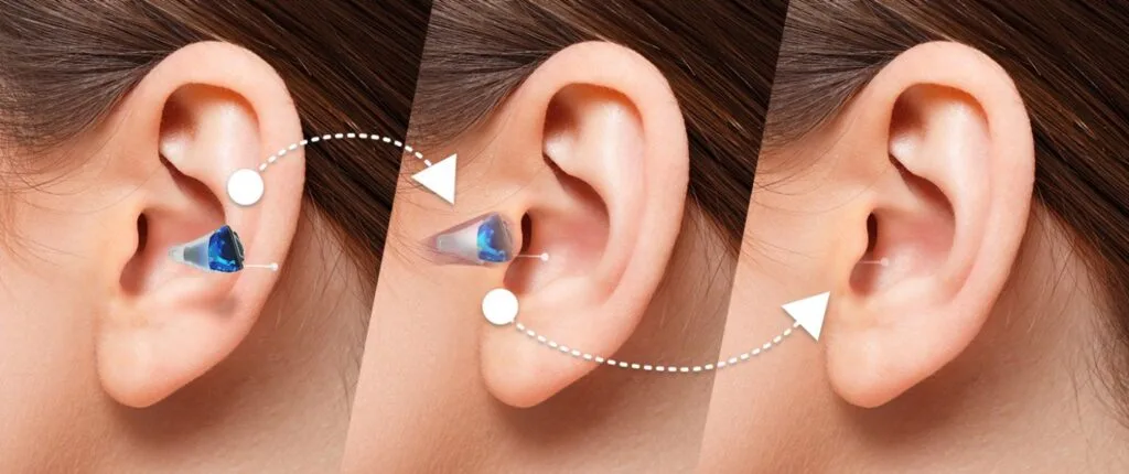 Hearing Aid